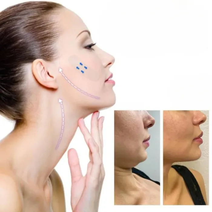 لاصق شد الوجه